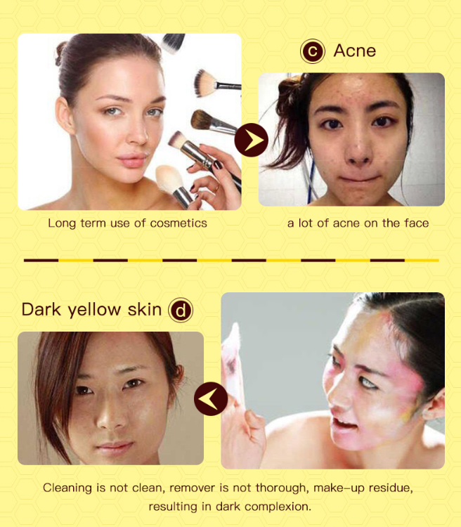 LaMille Honey Peel-Off Mask – Blackhead Removal & Deep Pore Cleansing